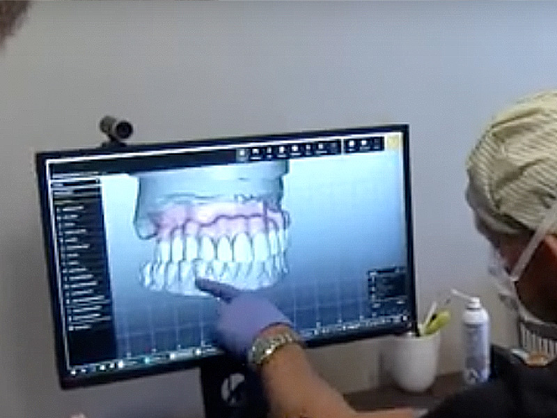 A person in a surgical mask is using a computer to view and manipulate a 3D model of a dental implant.