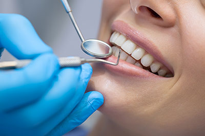 Dental hygiene in progress  a smiling woman undergoing teeth cleaning with dental instruments and blue gloves.