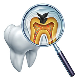 The image features a magnified view of a tooth with an open crown, showcasing the interior structure and dental pulp, viewed through a magnifying glass.