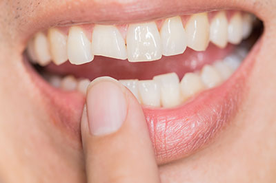 The image shows a person with their finger in their mouth, holding onto a tooth.